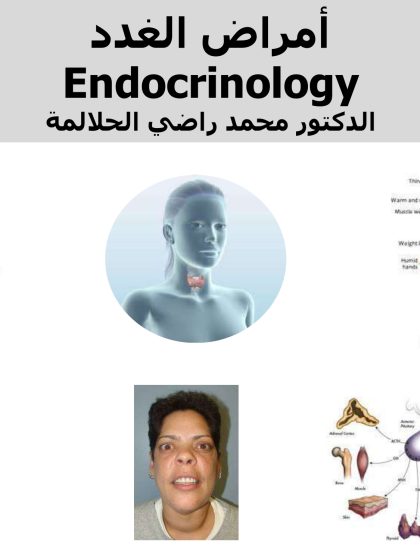 أمراض الغدد