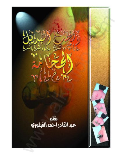 الطب البديل، الحجامة